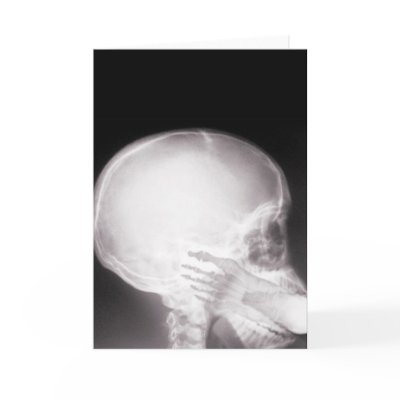 Foot in Mouth X-ray Greeting Cards by gravityx9