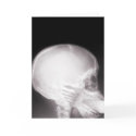 Foot in Mouth X-ray cards by gravityx9 Foot in Mouth X-ray cards