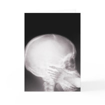 Foot in Mouth X-ray cards by gravityx9 Foot in Mouth X-ray cards
