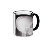 Foot in Mouth X-Ray Coffee Mug