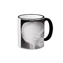 Foot in Mouth X-Ray Coffee Mug