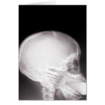 Foot in Mouth X-Ray Greeting Cards