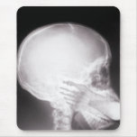 Foot in Mouth X-Ray Mouse Pad