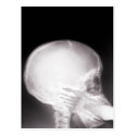 Foot in Mouth X-Ray Post Card