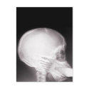Foot in Mouth X-ray postcards by gravityx9 Foot in Mouth X-ray postcards