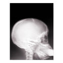 Foot in Mouth X-ray Poster posters by gravityx9 Foot in Mouth X-ray Poster posters