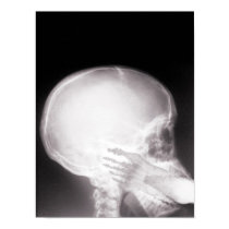Foot in Mouth X-ray Poster posters by gravityx9 Foot in Mouth X-ray Poster posters