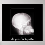 Foot in Mouth X-Ray Poster