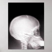 Foot in Mouth X-Ray Print