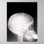 Foot in Mouth X-Ray Print