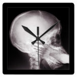 Foot in Mouth X-Ray Wall Clocks