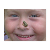 frog on nose postcards