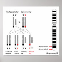 Genetics of hemophilia Poster