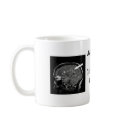 Get Personal With Your Lesion Load! mugs