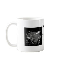 Get Personal With Your Lesion Load! mugs