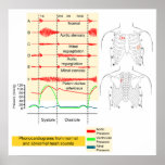 Graphically Recording of Heartbeat Sounds Diagram Print
