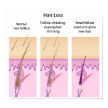 bald, care, organ, scalp, doctor, balding,