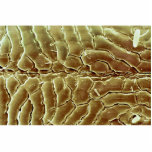 Hair Louse - chest Cut Out