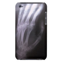 Hand xray IPOD TOUCH CASE