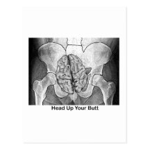 Head Up Your Butt Postcards