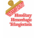 Hereditary Hemorrhagic Telangiectasia