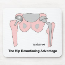 Hip Resurfacing Advantage Mouse Pad mousepads