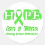 Hope for a Cure - Kidney Cancer Stickers