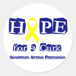 Hope for a Cure - Yellow Ribbon Round Stickers