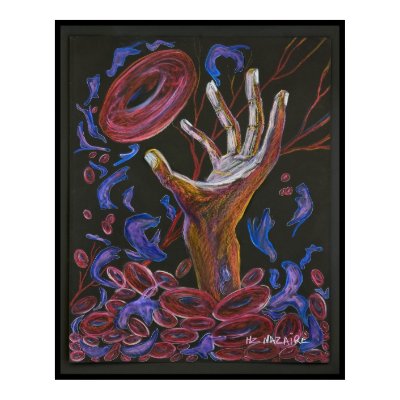 Hope - Sickle Cell Art Print by nazaire