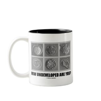 How Undeveloped Are You? (Embryos / Zygotes) mug
