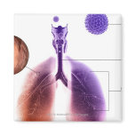 Illustration of an asthma attack from pollen fridge magnets