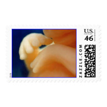 In-Utero Endoscopy Stamps