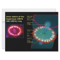 Inner Debris of the Supernova 1987A Ring Diagram Custom Announcement