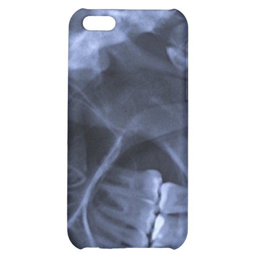 iphone 4 Jaw Xray (left handed) Blue iPhone 5C Case