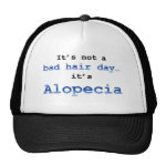 It’s not a bad hair day… it’s Alopecia Trucker Hats It’s not a bad hair day… it’s Alopecia Trucker Hats