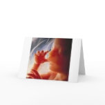 It's a Child.......Not a Choice!! Card