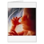 It's a Child.......Not a Choice!! Greeting Cards It's a Child.......Not a Choice!! Greeting Cards