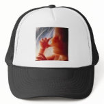 It's a Child.......Not a Choice!! Hats It's a Child.......Not a Choice!! Hats