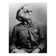 Joseph "John" Merrick The Elephant Man from 1889 Post Card