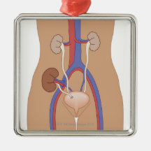 Kidney Transplant Ornament