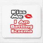 Kiss Me...I Am Battling Eczema Mouse Pads