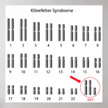 Klinefelter syndrome Poster