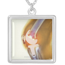 Knee replacement. Coloured X-ray of a total knee Pendant