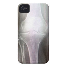 KNEE XRAY IPHONE COVER Case-Mate iPhone 4 CASES
