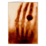 La primera X-Ray, 1901, fotografía tarjetas