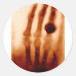 La primera X-Ray, 1901, fotografía calcomanías