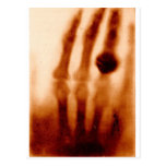 La primera X-Ray, 1901, fotografía tarjetas postales