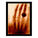 La primera X-Ray, 1901, fotografía tarjetas postales