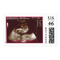 Lexi's Ultrasound postage