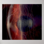 Lighting Over a Torn Cornea Poster posters